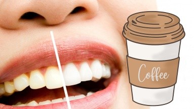 Dientes amarillos: ¿Es mejor cepillarse los dientes antes o después de tomar café? 