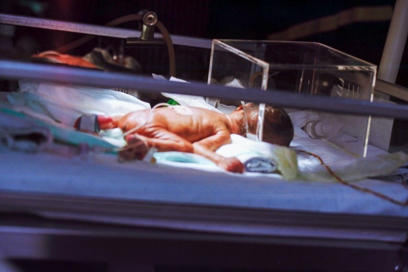 El 15.8% de las muertes fetales sucedieron durante el proceso del parto.FOTO:Hush Naidoo Jade Photography/UNSPLASH