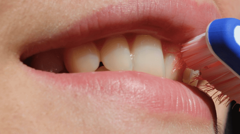 El cepillado excesivo de dientes puede provocar que aparezcan las aftas.(Pixabay)