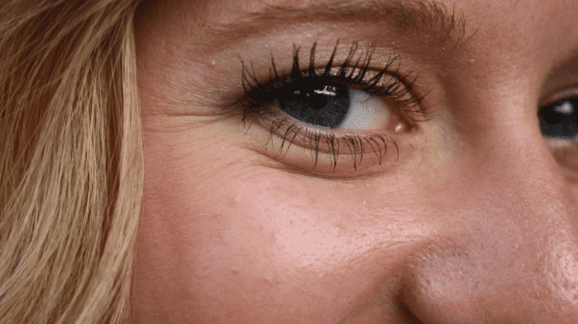 Las arrugas suelen aparecer con mayor facilidad en pieles claras.(Pixabay)