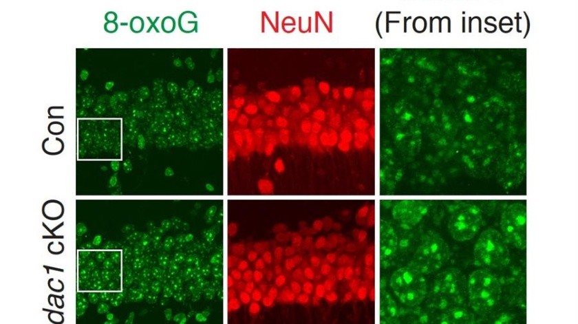 Fotografía facilitada por el Instituto Tecnológico de Massachusetts (MIT) en la que se ven neuronas en la fila inferior a las que les falta el gen HDAC1, que muestran niveles más altos de daño en el ADN (verde) que las neuronas normales.(EFE)