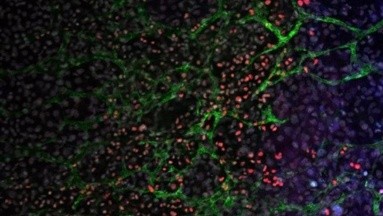 Nueva tecnología permitiría conseguir células madre más eficientes