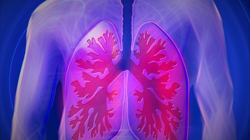 El cáncer de pulmón es uno de los cánceres que causa más muertes en el mundo.(Pixabay)