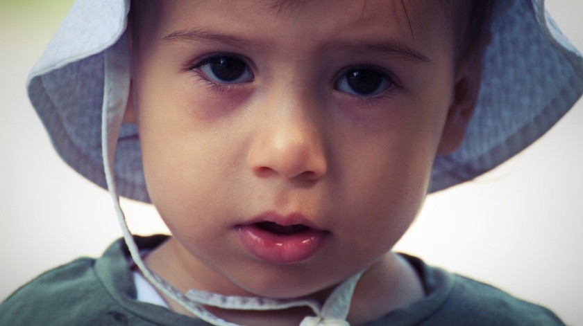 4 síndromes pueden provocar epilepsia refractaria en niños menores de 3 años.