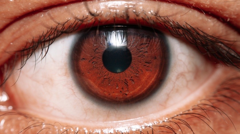 Los ojos rojos son un síntoma común de las las enfermedades de la superficie ocular.(Pexels)