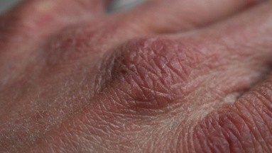 Alivia la piel seca a causa del constante lavado de manos por Covid-19