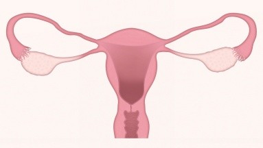 ¿Después de extraerte tumores en los  ovarios podrías quedar embarazada?