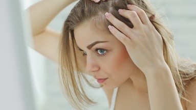 ¿Caída excesiva del cabello?: Estas pueden ser las causas 