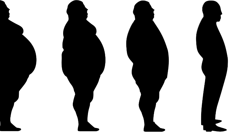 Se aclara que incluir este procedimiento en la Ley General de Salud es dotar de certeza jurídica, pero no es la única opción terapéutica para el tratamiento de la obesidad mórbida.(Pixabay.)
