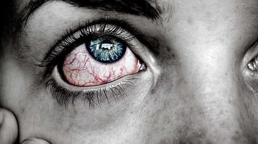 La inflamación o infecciones del ojo pueden causar enrojecimiento, al igual que picazón, secreción, dolor o problemas de la visión.(Pixabay)