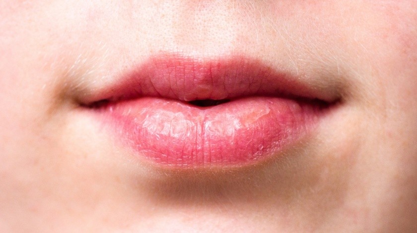 En el síndrome de Sjögren, éste ataca las glándulas que producen las lágrimas y la saliva. Esto provoca boca seca y ojos secos. (Pixabay)