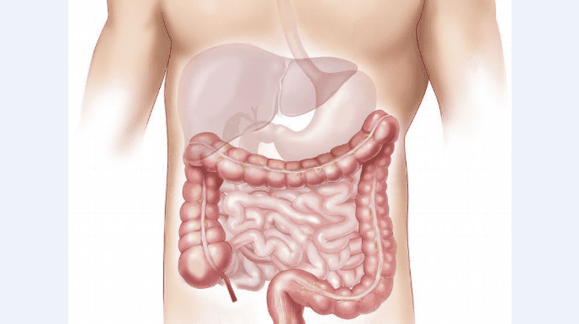 La salud del colon puede mejorar con una alimentación balanceada para así evitar problemas de salud a largo plazo.(Pixabay)