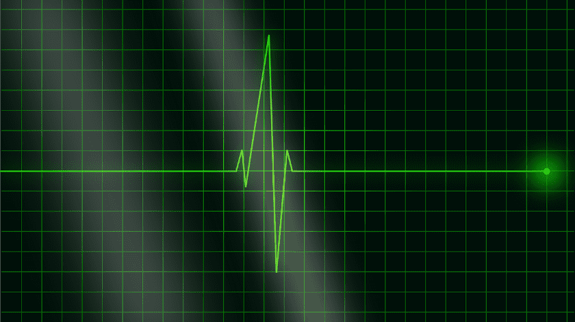 Una frecuencia cardíaca alta mientras estás en reposo puede ser una señal de alerta(Pixabay.)