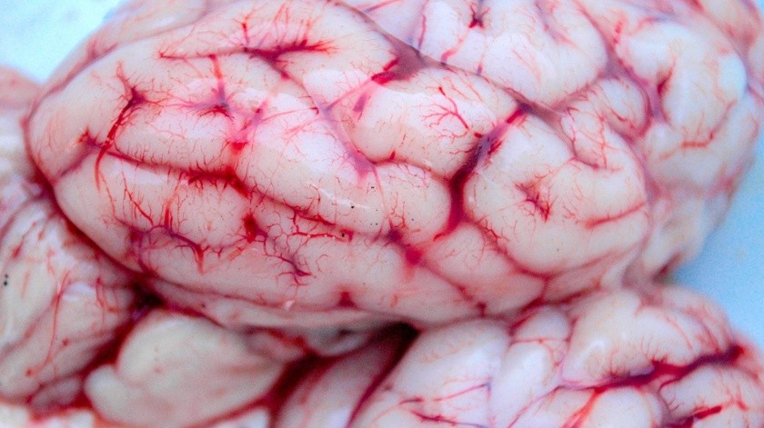 El infarto cerebral, ocurre cuando un coágulo se forma en alguna  arteria del cerebro, haciendo que la misma se obstruya, no haya flujo de sangre y con ello falta de oxigenación.(Pixabay.)