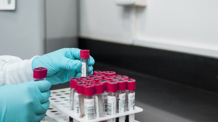 Algunas pruebas de laboratorio se hacen para diagnosticar, detectar o vigilar una enfermedad o afección específica.(Pixabay.)
