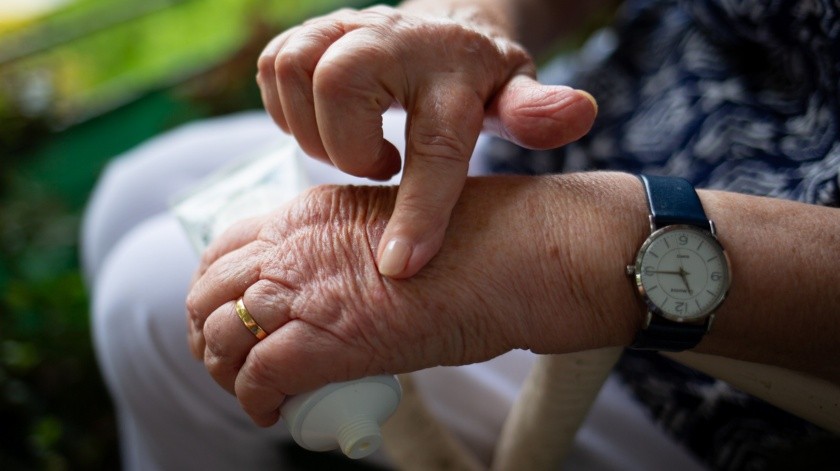 El frío o el calor puede ayudar a disminuir el dolor o inflamación que se presenta con la artritis.(Pixabay)