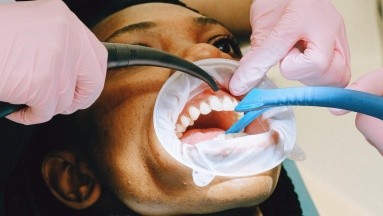 Estudio asocia pérdida de dientes en adultos mayores con mayor riesgo de demencia