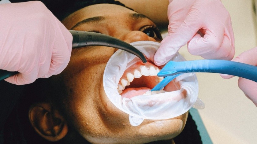 El estudio mostró que los adultos mayores que sufren pérdida de dientes tendrían un mayor riesgo de demencia.(Unsplash)