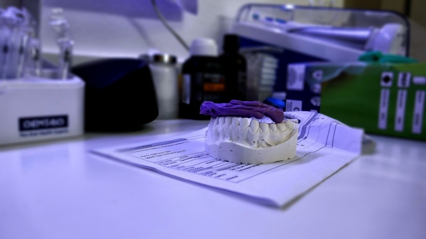 Si no atiendes el problema de salud de la mordida cruzada puedes tener consecuencias como desgaste de las piezas dentales, e incluso pérdida de los dientes.(Pixabay.)