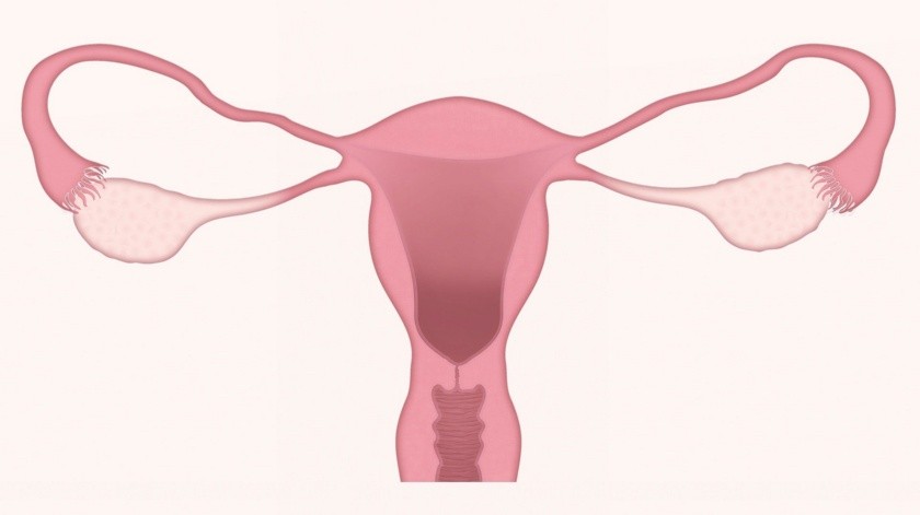 El cáncer de ovario es de los más frecuentes a nivel mundial.(Pixabay.)