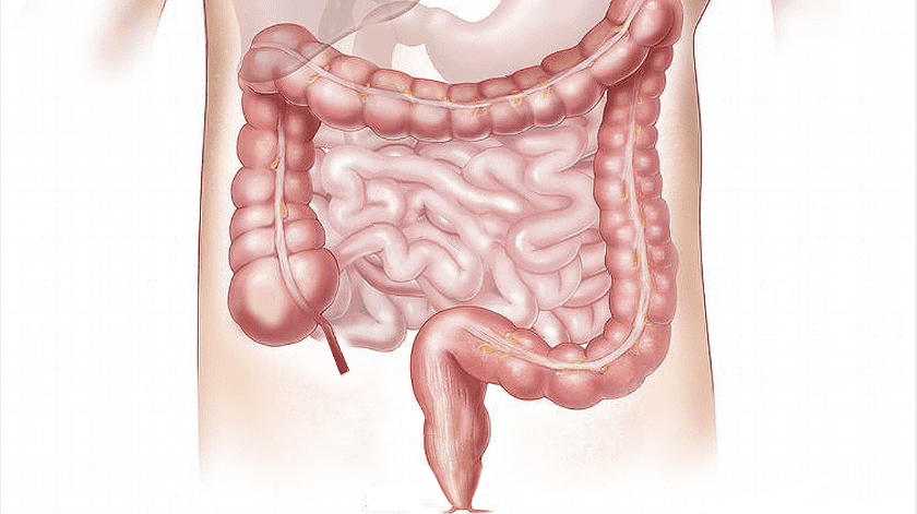 Estudios han asociado niveles normales de vitamina D con menor riesgo de cáncer de colon.(Pixabay)