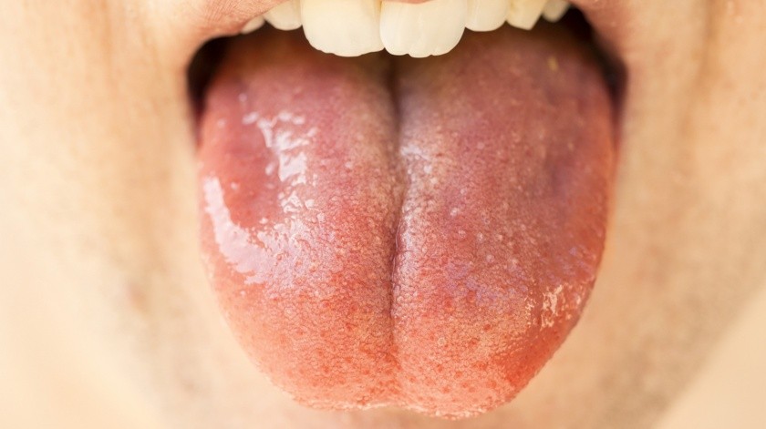 Las personas con la boca seca segregan menos saliva.(Pixabay.)