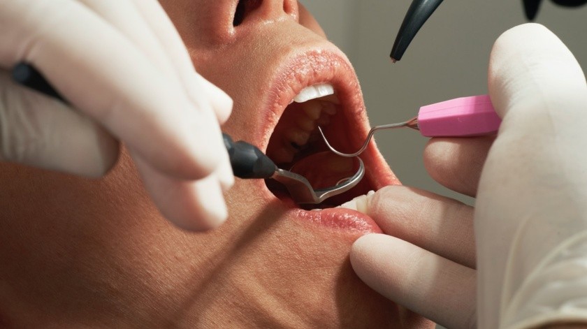 Un dentista puede conocer parte de tus hábitos al revisar tu boca.(Unsplash)