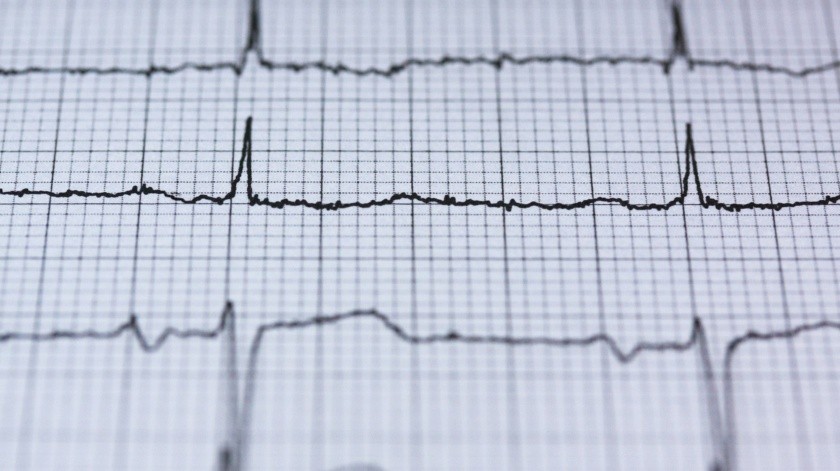 Un paro cardíaco debe ser atendido de inmediato.(Pixabay.)