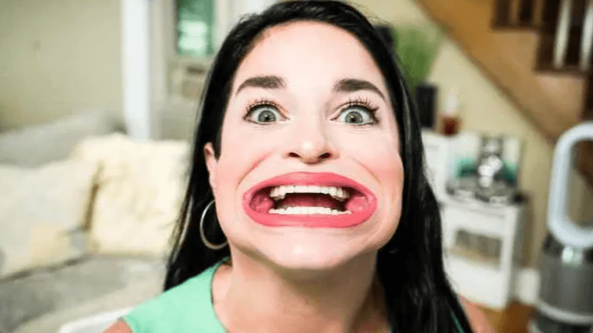 La mujer tiene el título de la boca más grande del mundo.(Guinness World Records)