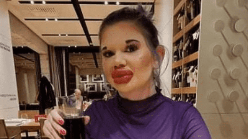 La joven no tiene miedo de que sus labios estallen.(Instagram)