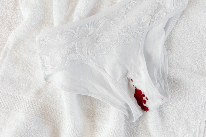 6 consejos para eliminar las manchas de menstruación de tu ropa | Mundo  Sano | Noticias e información para un estilo de vida saludable.