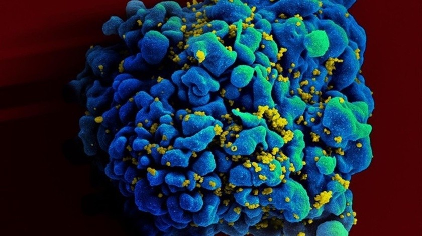 VIH/Sida habría infectado a 5.400 personas el año pasado.(EFE)