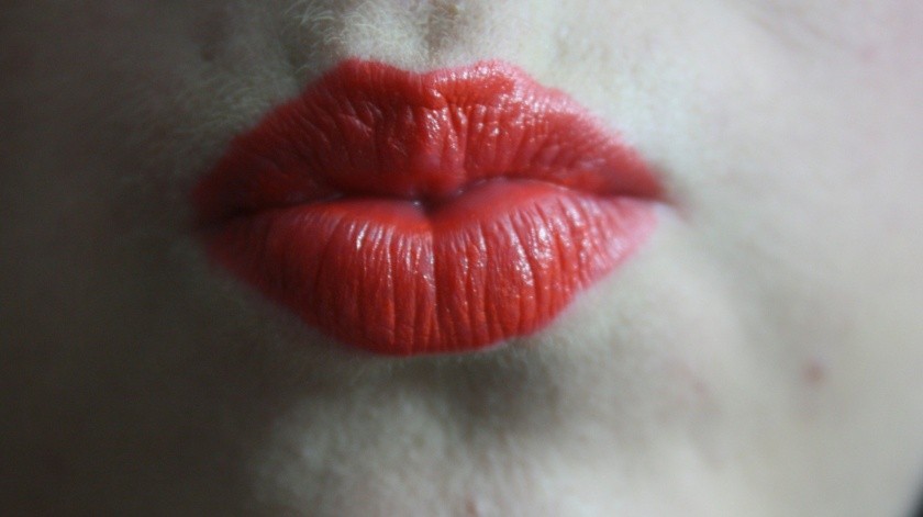 El alcohol produjo un efecto contrario luego que se inyectó los labios.(Pixabay.)