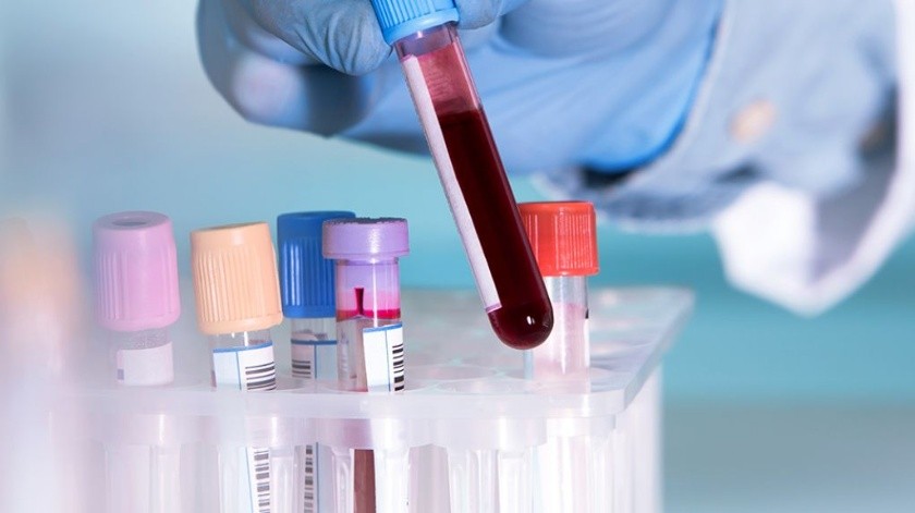 Una prueba de sangre puede volverse esperanzadora para saber más sobre el cáncer.(Universidad de Oxford.)
