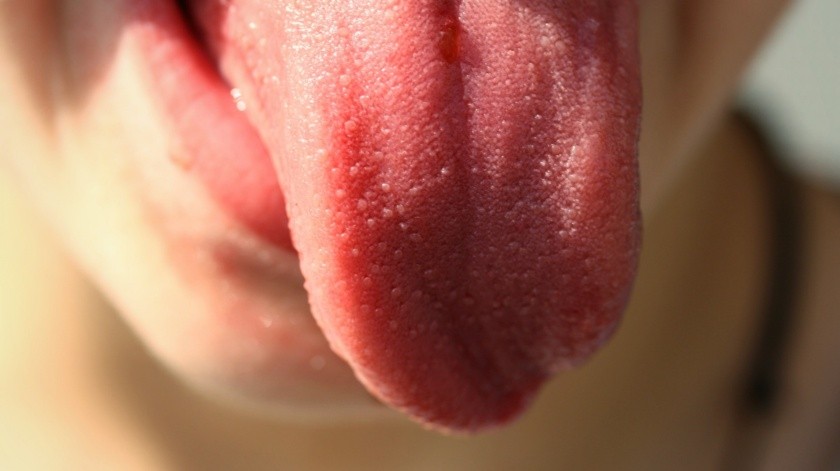 Hay muchas señales que puedes observar en tu boca y que podría tratarse de cáncer.(Pixabay.)
