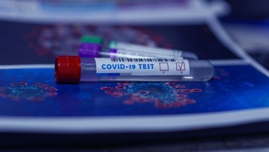 Covid: Vacuna Patria es segura y podría administrarse por la nariz
