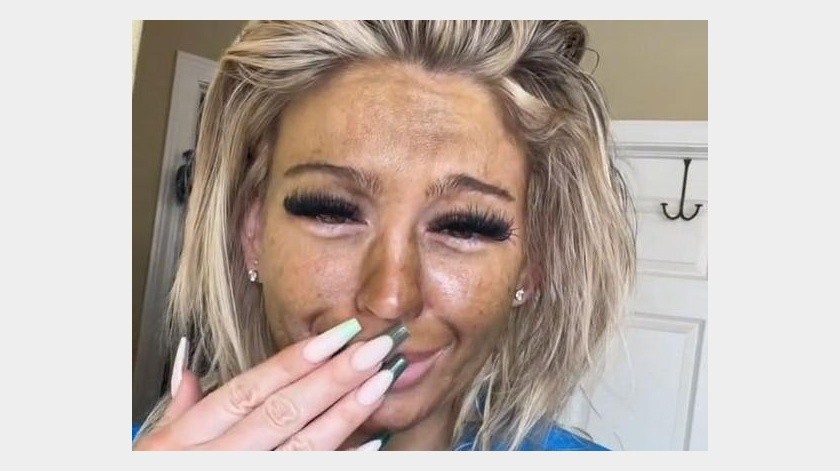 Esta mujer no se esperó que su rostro luciera con manchas tras un producto que aplicó