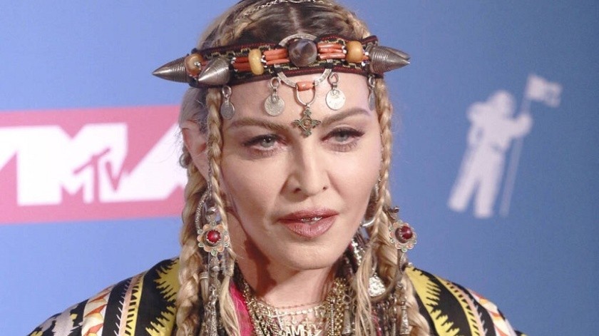 Madonna se ha realizado distintas cirugías estéticas.(Media Punch, INSTAR Images)