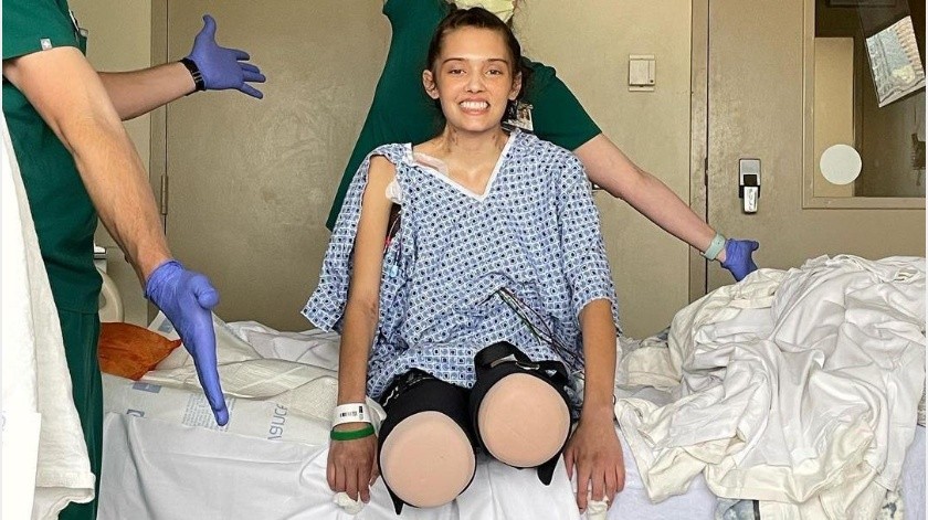 La amputación de piernas fue la forma de salvar la vida de Claire tras sufrir complicaciones por Covid-19.(Instagram)