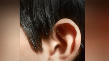 A niño con síndrome de Asperger le clavan la punta de un lápiz en un oído