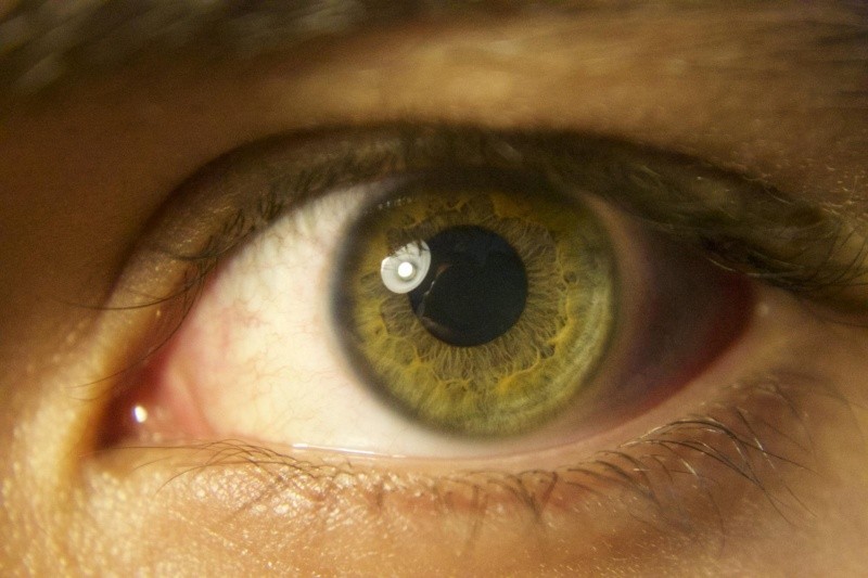 La revisión de la vista es clave para evitar enfermedades visuales. Pexels.  