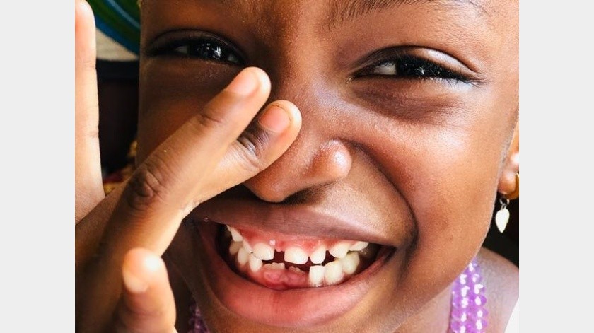 Los dientes de leche pueden conservarse.(Pexels.)
