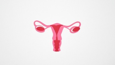 Cáncer de ovario: Factores de riesgo