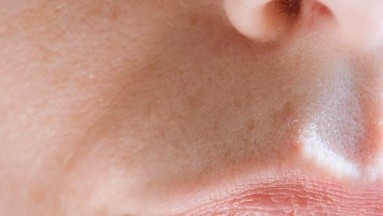 Aerosoles nasales: Consejos para que funcionen correctamente