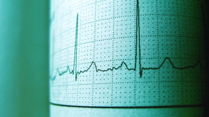 La insuficiencia cardíaca puede aparecer por diferentes razones.(Pexels.)