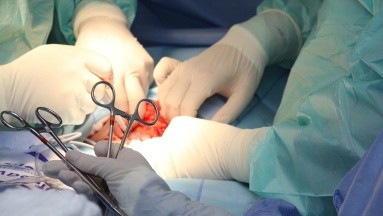 Modifican Ley sobre donación de órganos en Suiza y abre polémica