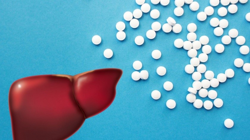 Hepatitis: La sobredosis de paracetamol podría causar inflamación del hígado(Canva/Pixabay/Pexels)