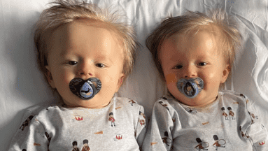 Padres descubren que sus gemelos 