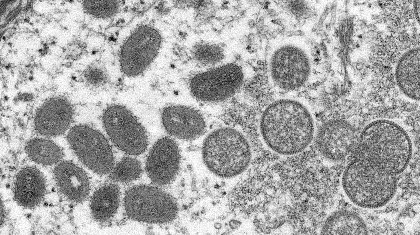 Según la OMS la viruela del mono no se convertirá en pandemia