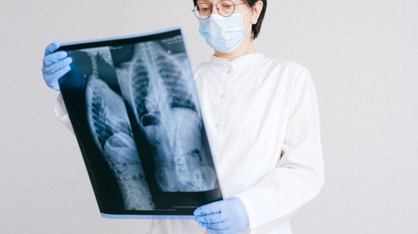 Una experta señaló que la tecnología de biomarcadores ayuda a mejorar tratamiento de cáncer de pulmón.(Pexels)